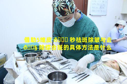 借助5维皮 🐘 秒祛斑除皱与去 🐧 除综合斑的具体方法是什么